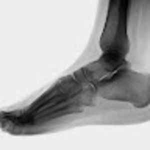 Meet your Posher, Luke